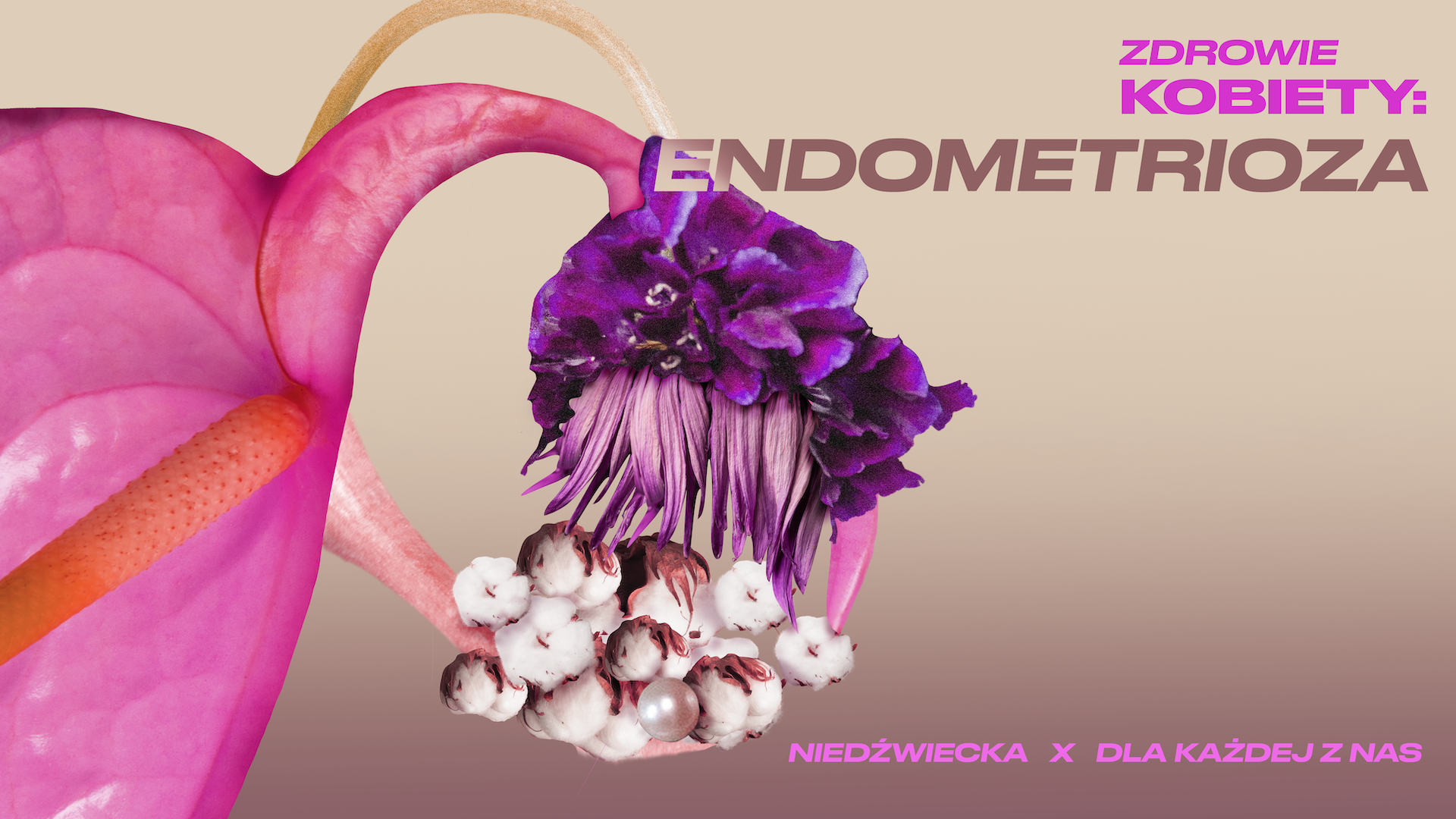 Endometrioza – Zdrowie Kobiety